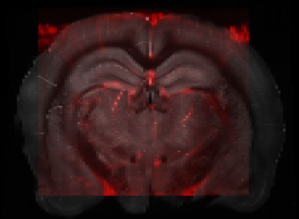 Resulting alignment of fUSi-based in vivo vascular map and in-vitro brain.